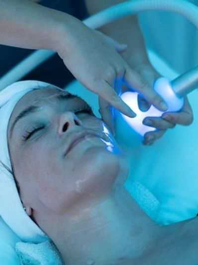 non-invasive facelift Cryoskin facial before and after Cryo cryo-facial cryotherapy cryofacial