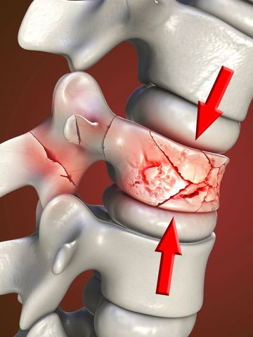 Prp Injection Knee, Prp, Stem Cells - Revive Spine and Pain Care