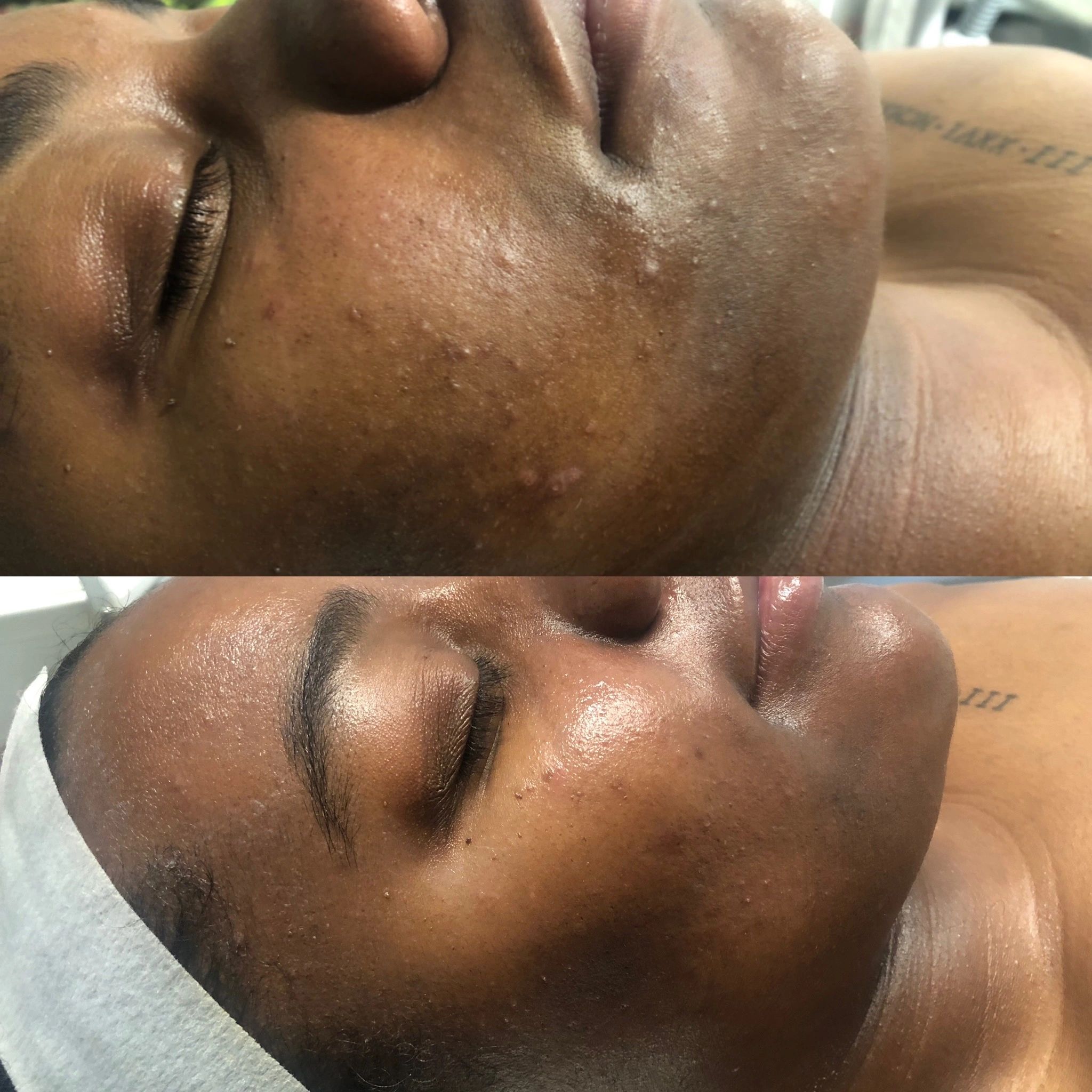Clean, professional medical spa treatment room with neutral tones at Mimi's Spa - Facials & Head Spa in Buckhead