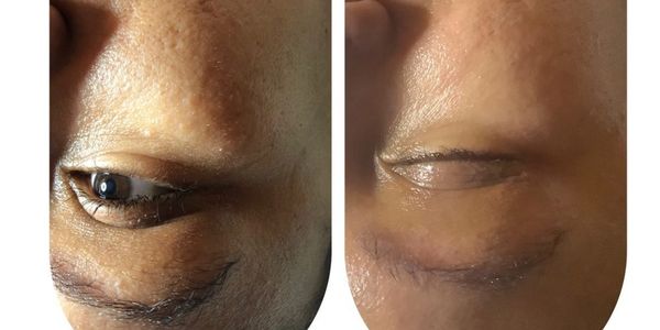 “Miconedding Brookhaven”