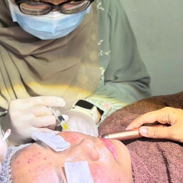 A healthcare professional performs a facial treatment on a patient with acne.