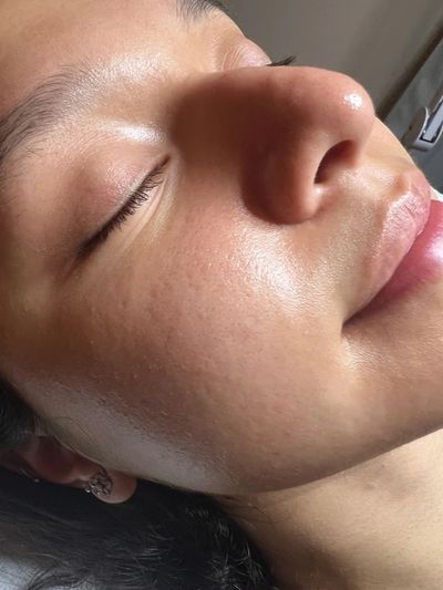 Close-up of a person's smooth, glowing skin.