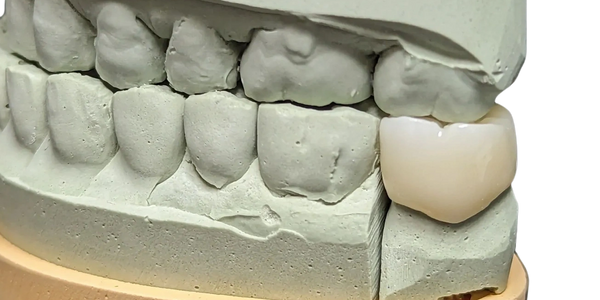 Zirconia crown