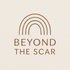 Beyond Scar