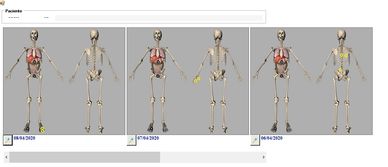 Modulo OsteoDiagnostic para el seguimiento de las diferentes sesiones de osteopatía de un paciente