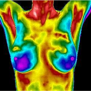 breast thermography near me