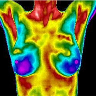 Space Coast Thermography - Boobs! They come in all different