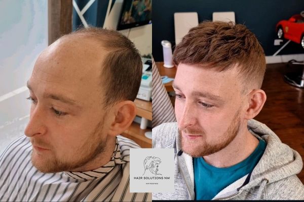 A side-by-side comparison of a person's hair before and after the application of a hair system.