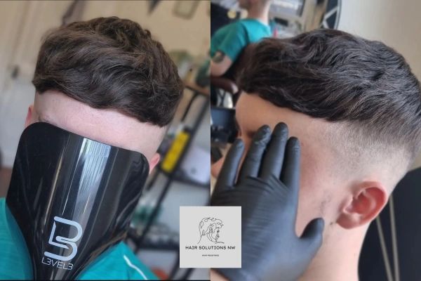 Before and after image of a full head treatment by Hair Solutions NW