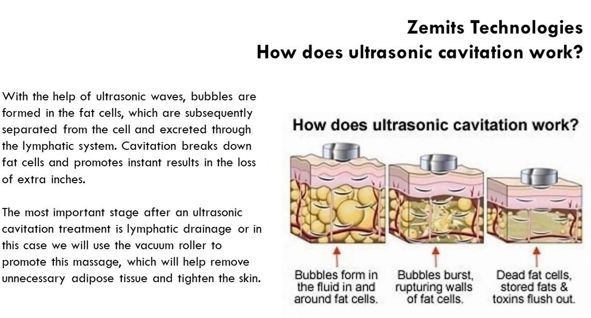 How does it work - Zemits Bionexis introduction Body shaping, skin tightening and reduce cellulites