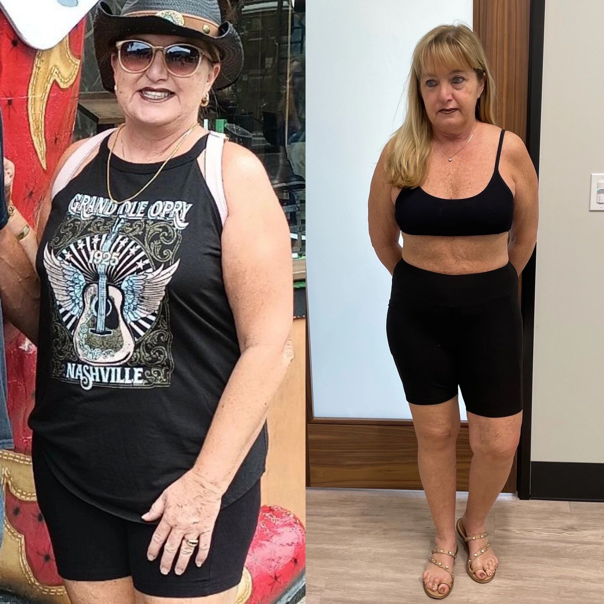 semaglutide weight loss marble cliff Semaglutide Review: 'The Drug Helped Me Lose 30 Pounds At Age 52'