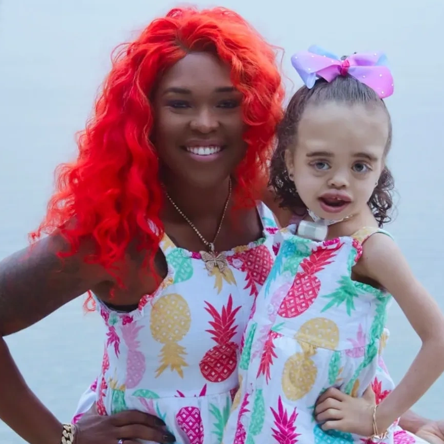 A girl with MSS and her mother are posing for the camera wearing matching pineapple dresses.