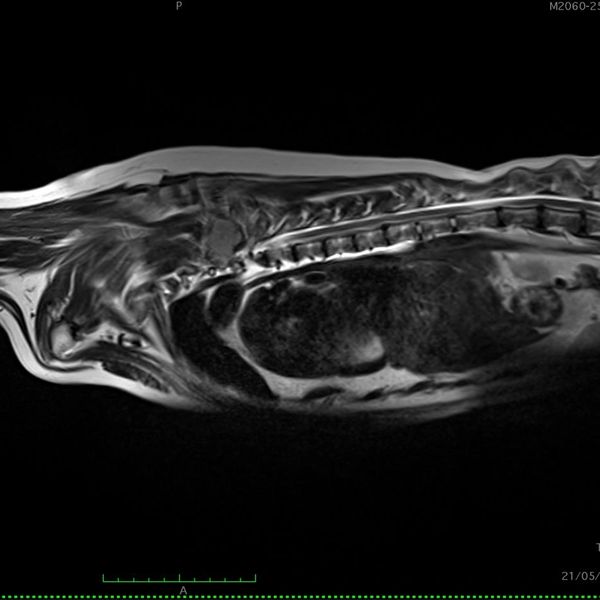 Neurosurgery MRI CTScan brain surgery spine surgery 