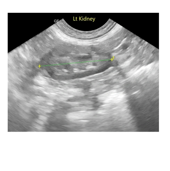 ultrasound sonography diagnostic value better patient care treatment USG state of the art care 