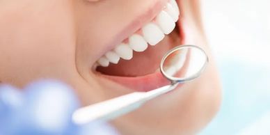 Close-up of a smiling mouth with dental mirror.