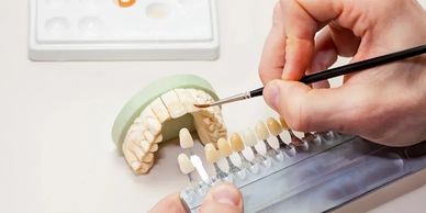 A dental technician painting a dental mold with shade guide.