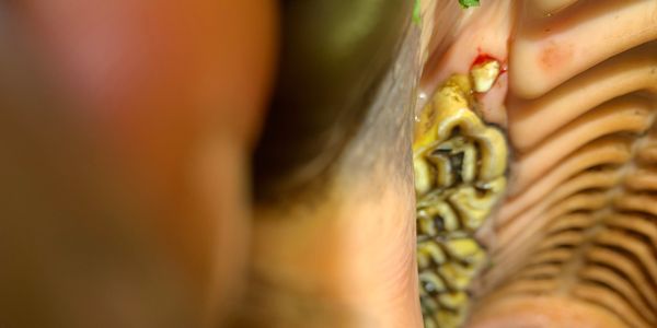 Wolf tooth in horses mouth