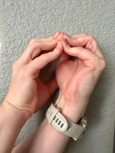 Sara's hand showing excess joint movement within the same limb