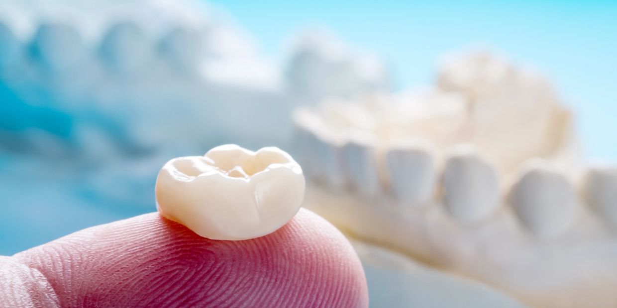 Dental crown