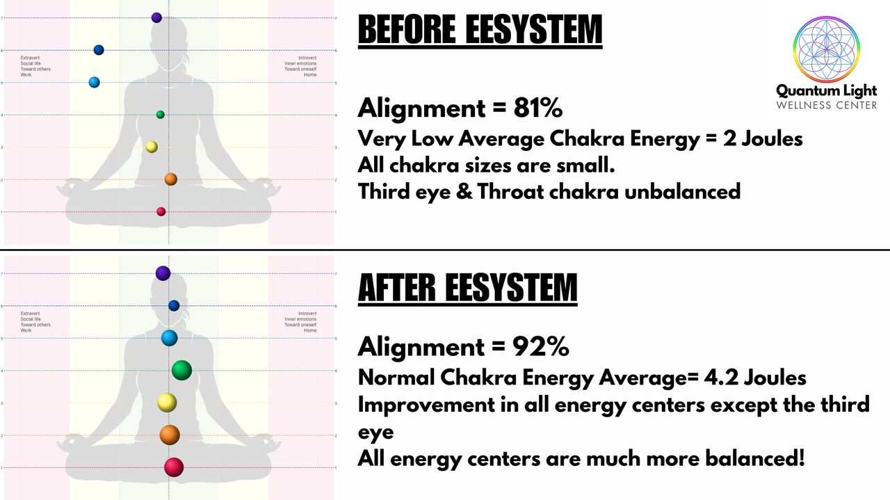 Before her EESystem session, her chakra alignment was at 81%. Not terrible, but the amount of energy running through the energy centers was very low (2 joules). Normal is between 4 & 6. Her 3rd eye & throat chakras were in a state of disbalance. After her 2 hour EESystem session, you can see her alignment is at 92% - a HUGE improvement. The energy running through the energy centers is significantly improved too! Before her EESystem session, her chakra alignment was at 81%. Not terrible, but the amount of energy running through the energy centers was very low (2 joules). Normal is between 4 & 6. Her 3rd eye & throat chakras were in a state of disbalance. After her 2 hour EESystem session, you can see her alignment is at 92% - a HUGE improvement. The energy running through the energy centers is significantly improved too!