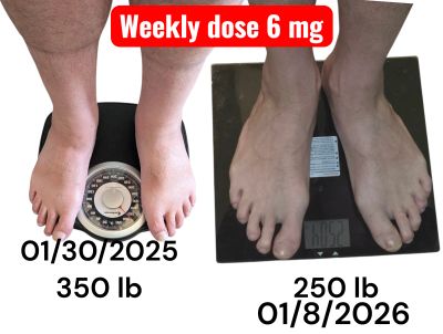 Before and after weight loss with 6 mg weekly dose.