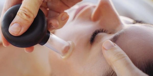 A facial cupping therapy session being performed on a woman's face.