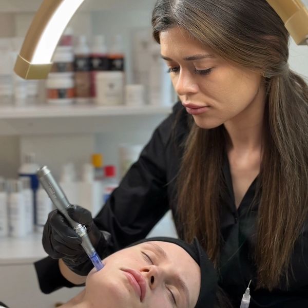 microneedling for improved skin texture and elasticity