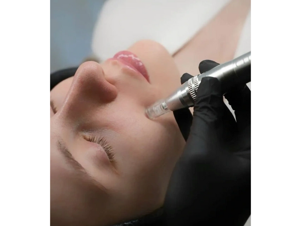 Microneedling treatment enhanced with exosome serum for skin regeneration