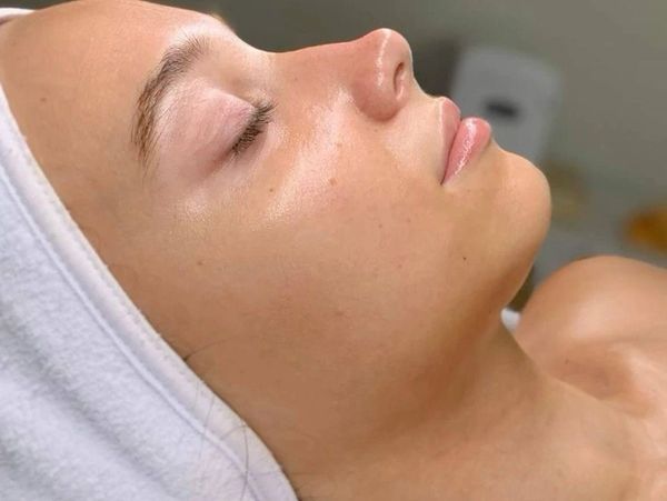 Skin results after Glow facial treatment