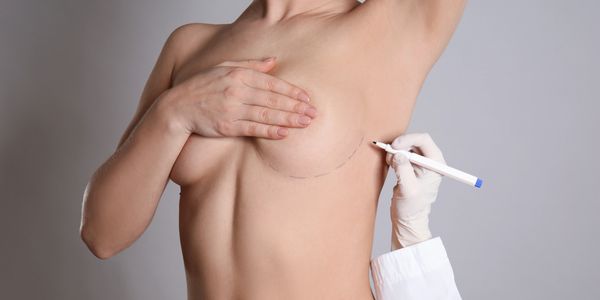 Cirugía plástica con el fin de aumentar las mamas con prótesis mamarias logrando belleza corporal.