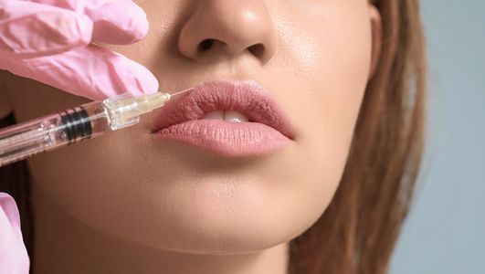 Colocación de ácido hialurónico o filler para crear definición y voluminización de los labios.