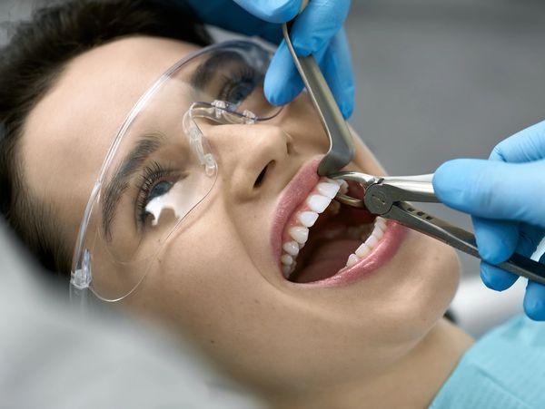 Dentist extracting a tooth.