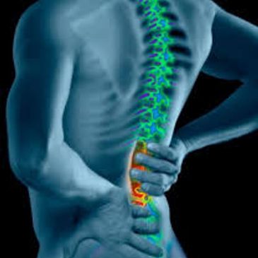 back pain and stiffness
