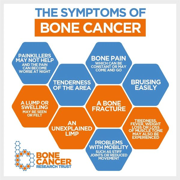 IMAGE CREDIT: Bone Cancer Research Trust