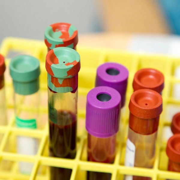 Test tubes with colored caps in a yellow rack.