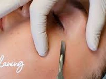 A close-up of a facial skin treatment being performed with a scalpel.