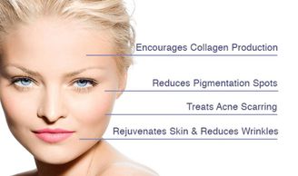 Microneedling Collagen Induction Therapy 