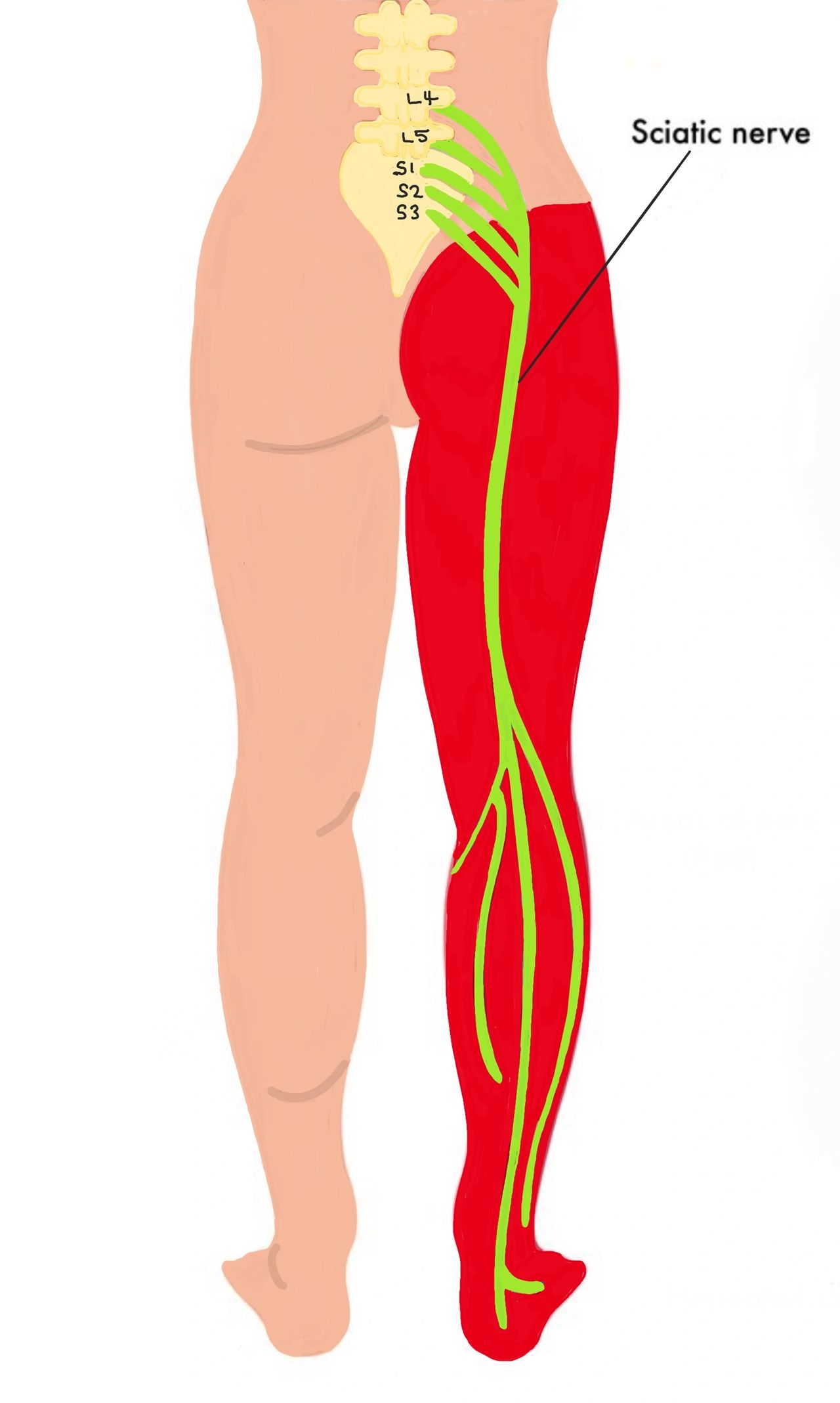 How can a person manage sciatic nerve pain at night?