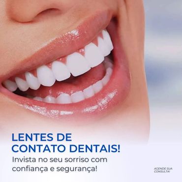 lentes de contato dentais