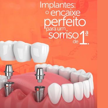 implate dentário 