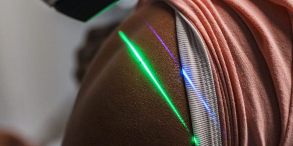 Green and blue laser beams on a person's shoulder near a pink shirt.