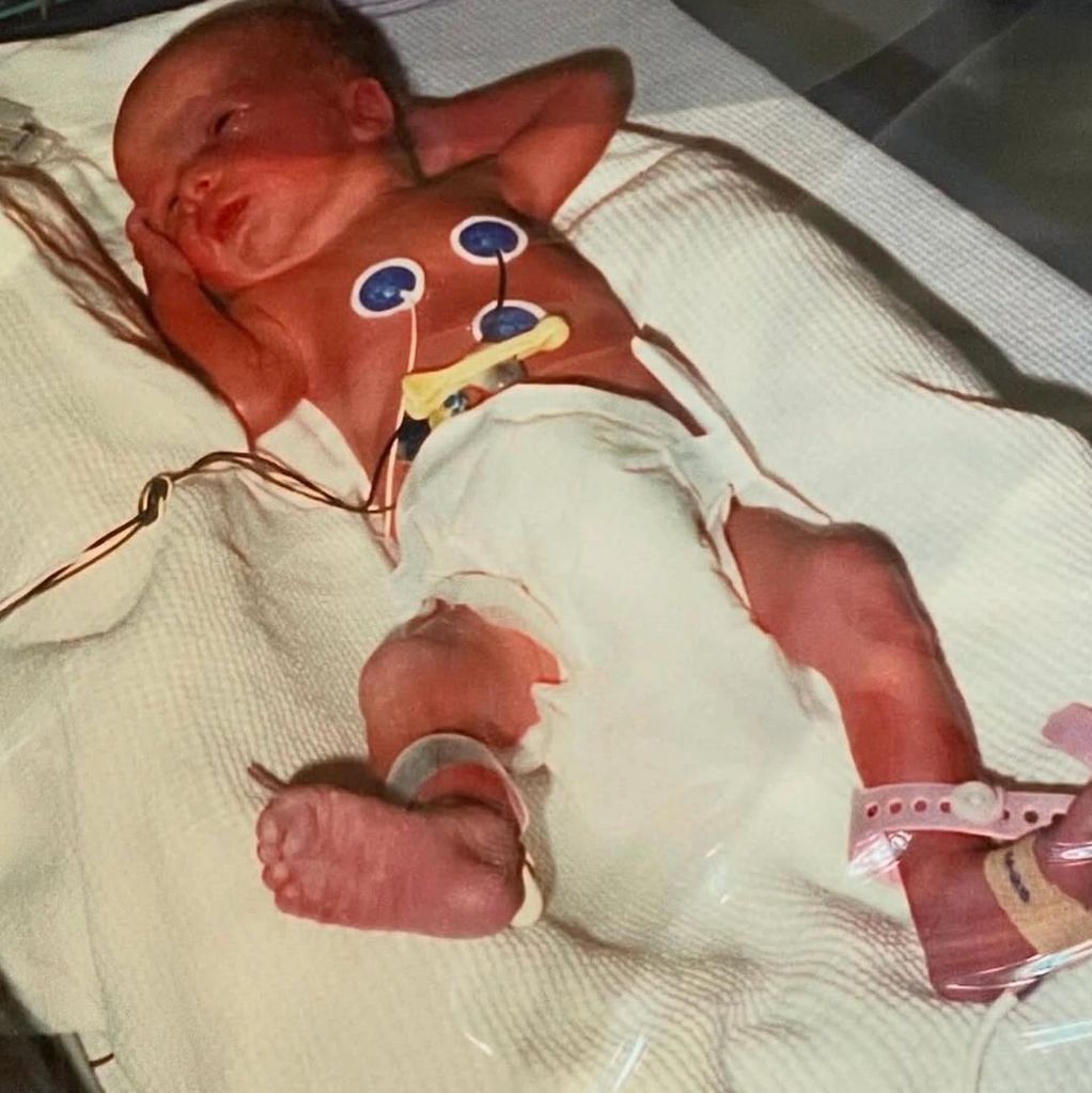 Premature newborn in an incubator with medical monitoring devices.