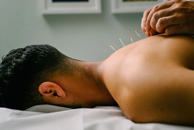 Acupuncture needles in back