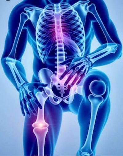 Inflammation in the body 