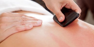 Gua Sha being preformed on a back
