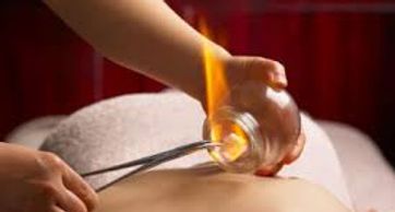 Fire Cupping 