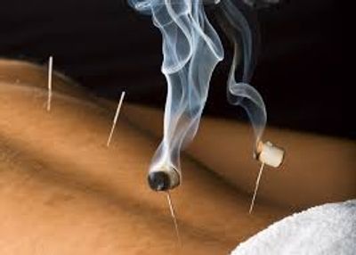 Moxibustion being burnt on top of Acupuncture needles