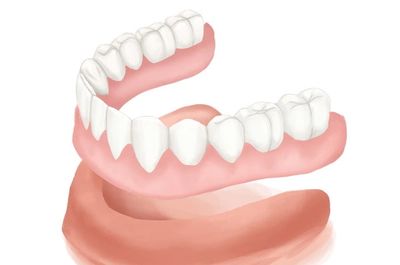 permanent dentures in chandigarh
