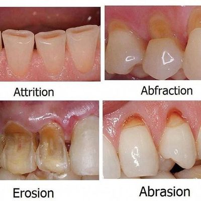 best dentist in chandigarh