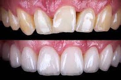 smile designers chandigarh